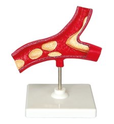 Artery structure model